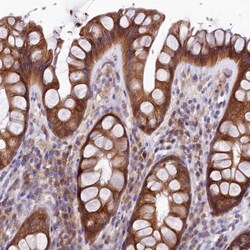 QARS Antibody, Novus Biologicals 0.1mL; Unlabeled:Antibodies, Polyclonal